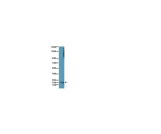 62-8371-51 Anti-acetyl-Lysine, clone 4G12; 100 μg 05-515