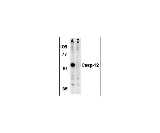 62-8448-27 Anti-Caspase 12, prodomain, aa 100-116; 100 μg AB3612