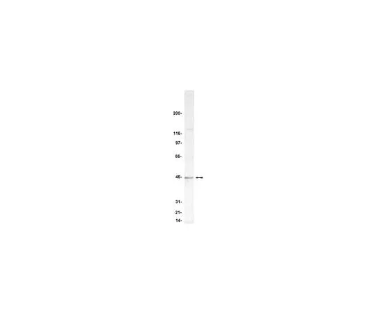 62-8383-69 Anti-PP2A-methylesterase/PME-1; 200 μg 07-095