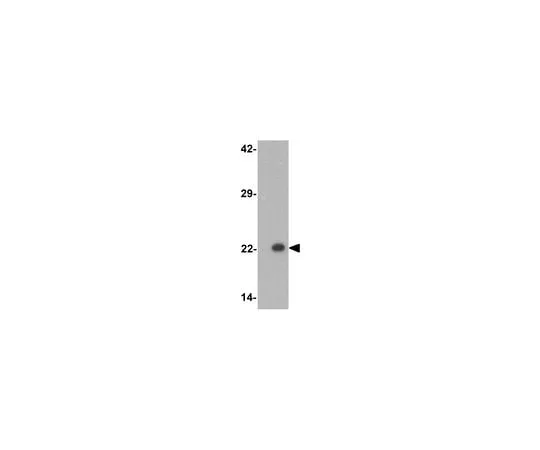 62-8459-85 Anti-PHOX2B ABD132