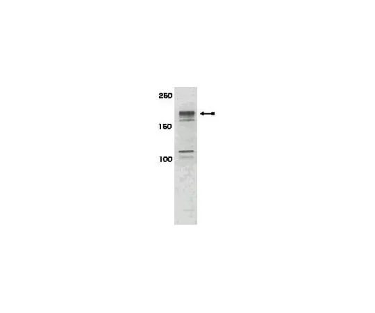 62-8386-80 anti-phospho-IRS1 (Ser616); 100 μL 07-843