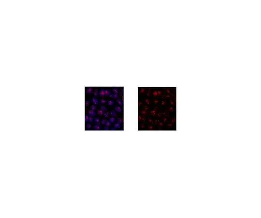 62-8461-26 Anti-Tet2 Antibody, Cat. No. ABE364 ABE364