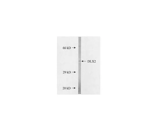 62-8451-21 Anti-Dlx2; 100 μg AB5726