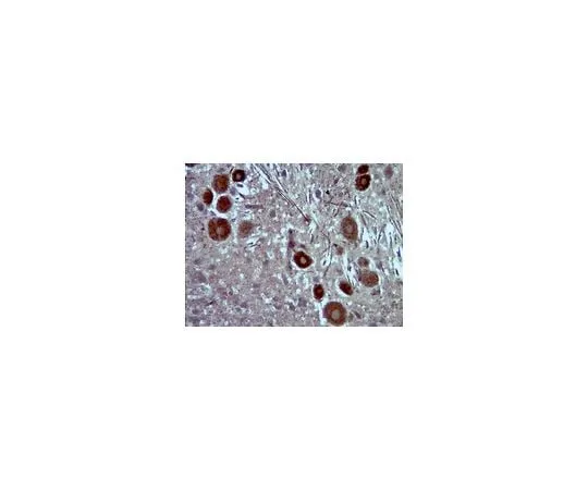 62-8465-35 Anti-PDE11A; 100 μg ABN34
