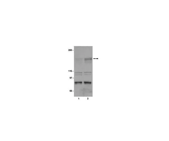 62-8384-71 Anti-phospho-KDR/Flk-1/VEGFR2 (Tyr1214); 200 μg 07-374