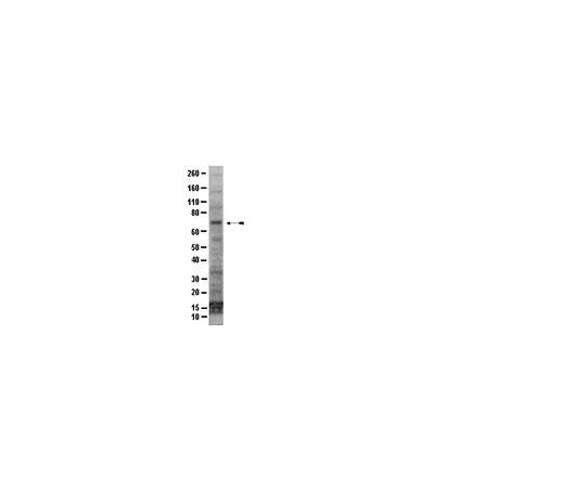 62-8388-20 Anti-IRAK1, C-terminus; 100 μg 07-1601