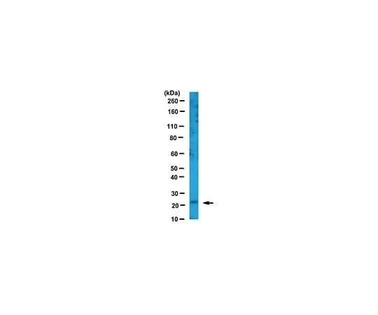 62-8458-27 Anti-Thymidylate Kinase/TMPK ABC458