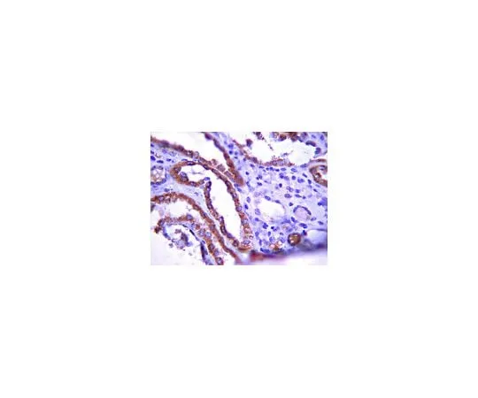 62-8382-95 Anti-Protein patched homolog 1; 100 μg 06-1102