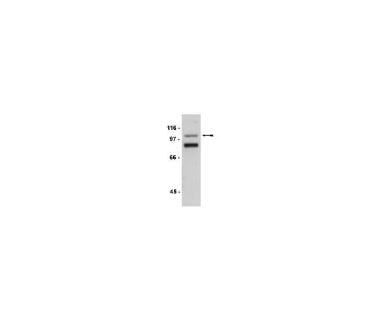 62-8385-81 Anti-Ago 2; 200 μg 07-590