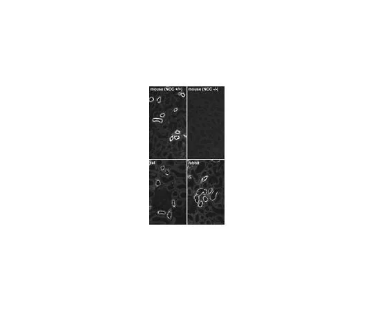 62-8448-08 Anti-Thiazide-sensitive NaCl Cotransporter; 50 μL AB3553