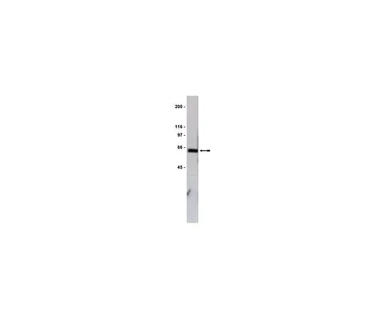 62-8381-29 Anti-GST Tag; 200 μg 06-332