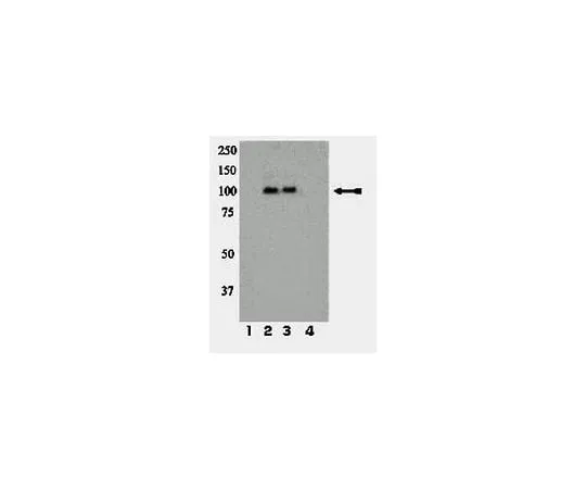 62-8386-79 anti-phospho-IR/IGF1R (Tyr1158/Tyr1162/Tyr1163); 100 μL 07-841