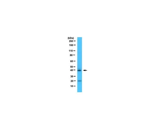 62-8462-76 Anti-NeuroD1 ABE991
