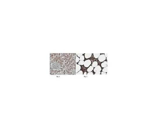 62-8464-47 Anti-NLRP6 (NALP6); 100 μg ABF29