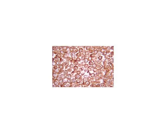 62-8387-63 Anti-Glycogen Synthase Kinase-3 beta (GSK3 beta), a.a. 335-349; 50 μg 07-1413