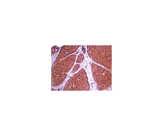 62-8389-20 Anti-ASPM; 100 μg 09-066