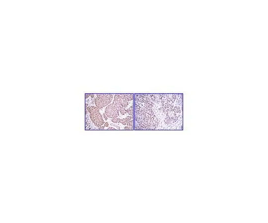 62-8387-69 Anti-PDGF-BB; 100 μL 07-1437