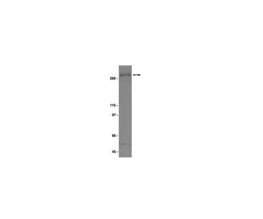 62-8385-05 Anti-BRCA1; 100 μL 07-434