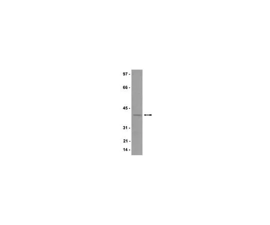 62-8385-43 Anti-p40-phox; 200 μg 07-503