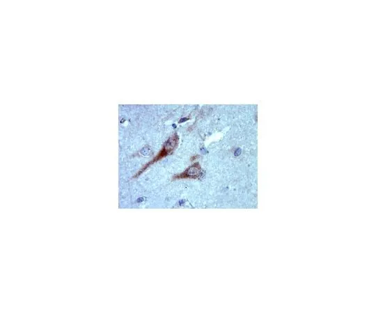 62-8465-38 Anti-RAB35; 100 μg ABN38