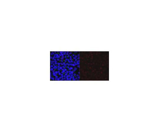 62-8462-90 Anti-ALKBH5 Antibody ABE1013-I