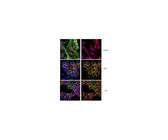 62-8460-12 Anti-Ebp1 N-terminal; 100 μL ABE43