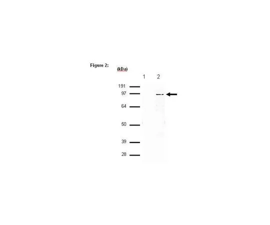 62-8367-52 RIPAb+(TM) SUZ12; 10 assays 03-179