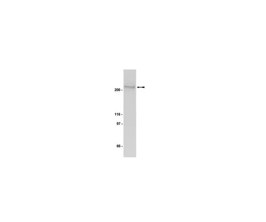 62-8372-39 Anti-phospho-Acetyl CoA Carboxylase (Ser79), clone BK102; 200 μg 05-673