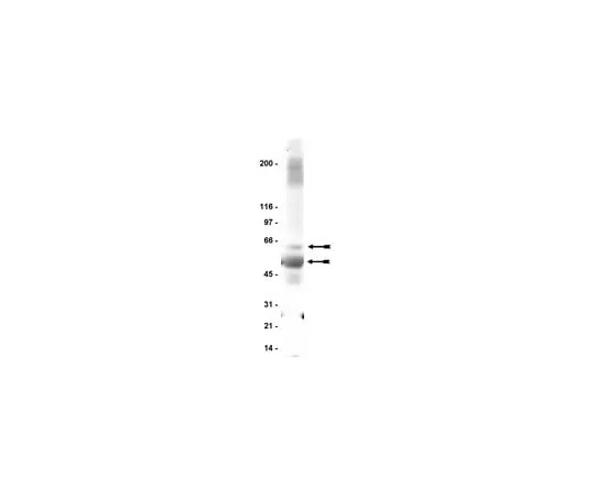62-8371-28 Anti-GABA A Receptor β2/3, clone 62-3G1; 200 μg 05-474