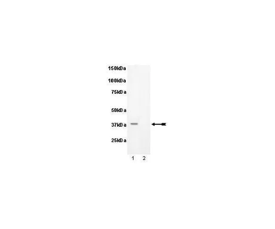 62-8386-87 anti-phospho-PKA Catalytic β subunit (Ser338); 100 μL 07-868