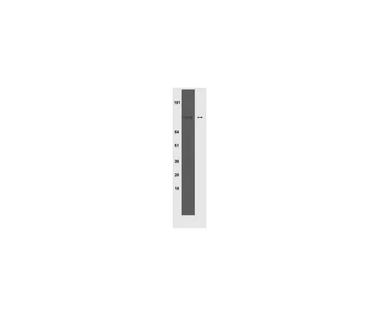 62-8368-28 Anti-phospho-Insulin Receptor (Tyr 1150/1151), clone 10C3; 100 μg 04-299