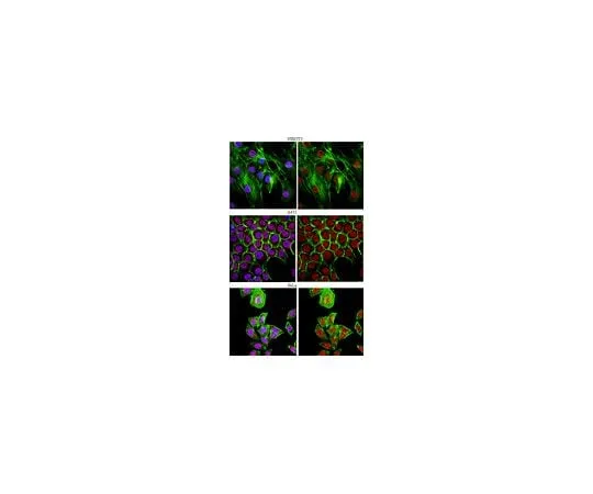 62-8383-11 Anti-U1-70K; 100 μg 06-1297