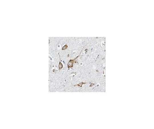 62-8468-24 Anti-Potassium Channel KCNQ5 ABN1372