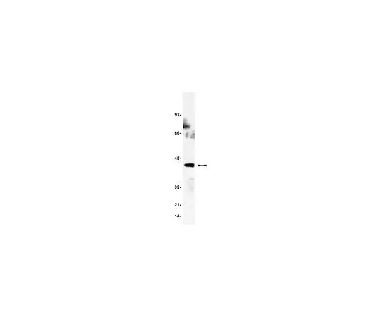 62-8382-50 Anti-GADS; 200 μg 06-983
