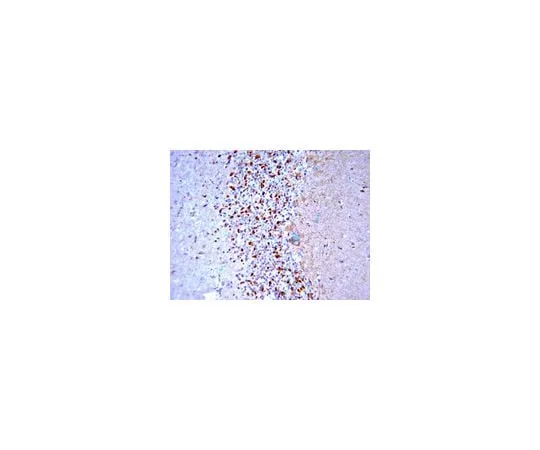 62-8452-03 Anti-BACE, C-terminus; 100 μg AB5940