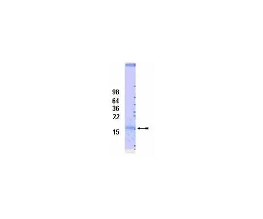 62-8391-68 UbcH7 Conjugating Enzyme; 100 μg 14-813