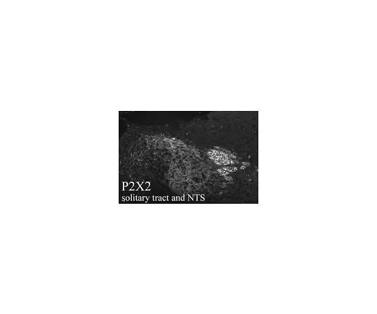 62-8451-85 Anti-P2X2 Receptor; 50 μL AB5894