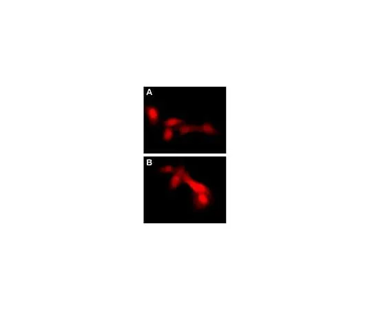 62-8394-40 LentiBrite(TM) RFP-LC3 Control Mutant Lentiviral Biosensor 17-10188