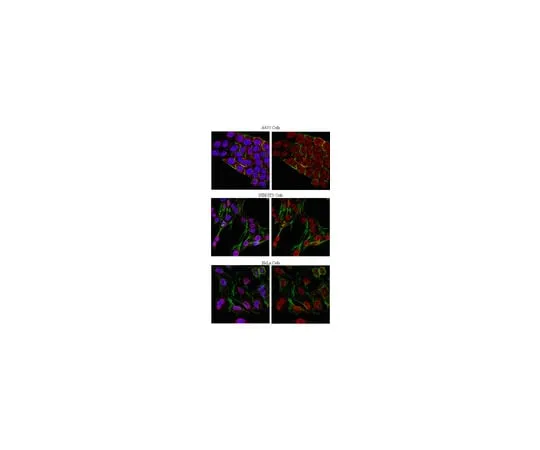 62-8375-48 Anti-phospho-Threonine, clone 20H6.1; 100 μg 5-23