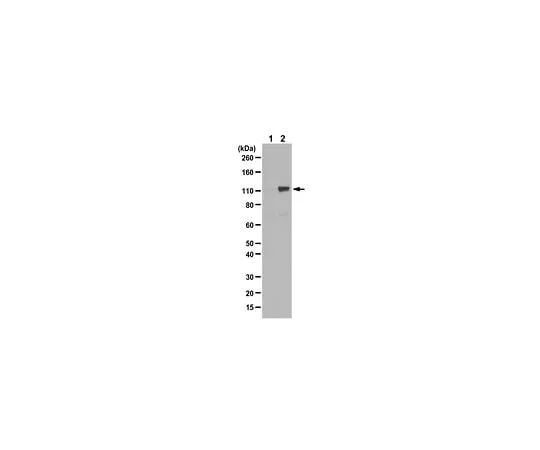 62-8387-46 Anti-phospho-Androgen Receptor (Ser81) 07-1375