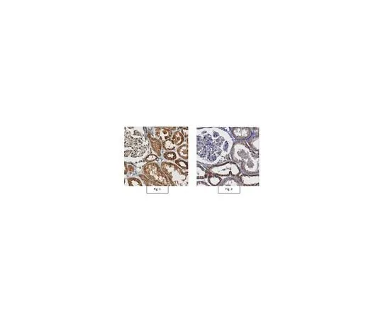 62-8458-48 Anti-Cytosolic 5'-nucleotidase II Antibody ABC481