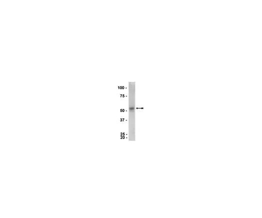 62-8373-54 Anti-Parkin, clone PRK8; 100 μL 05-882