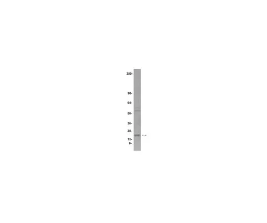 62-8371-80 Anti-Endostatin, clone 1837.46; 200 μL 05-579