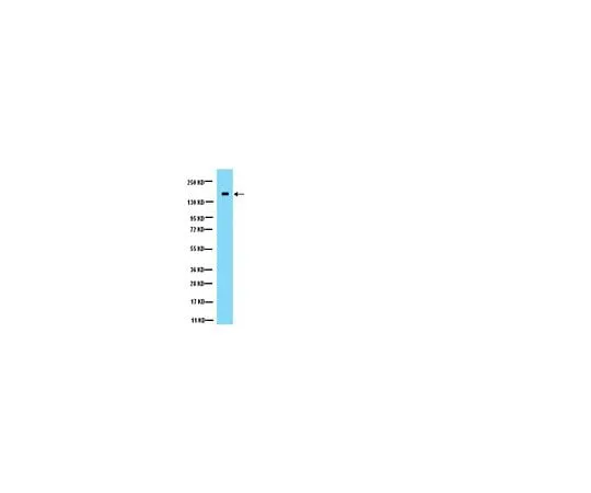 62-8445-28 Anti-NMDAR2A; 10 μg AB1555P