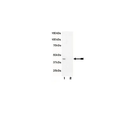 62-8386-84 anti-phospho-MEK1 (Thr292); 100 μL 07-852