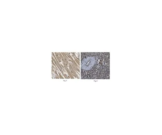 62-8467-19 Anti-PQBP1 ABN439