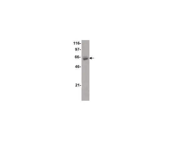 62-8393-51 ChIPAb+ Estrogen Receptor α; 25 assays 17-603