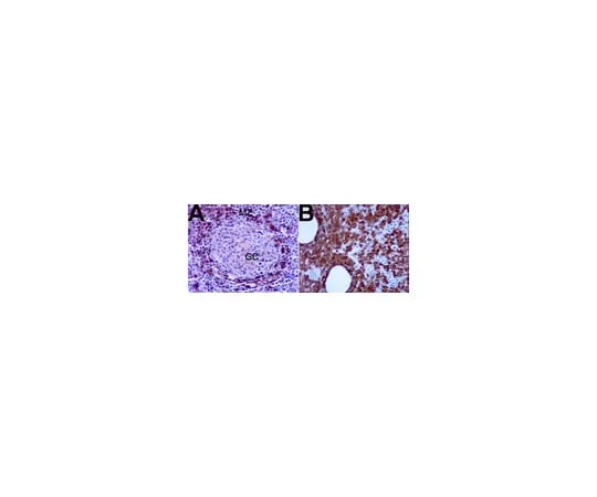 62-8373-89 Anti-TCL1; 100 μL 05-954