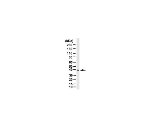 62-8466-08 Anti-ZFP36L1 Antibody Cat. No. ABN192 ABN192