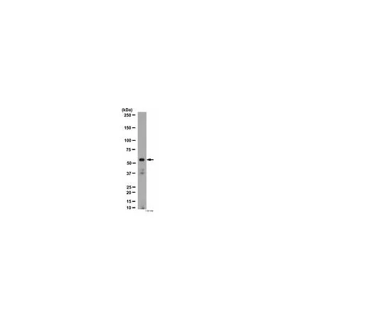 62-8455-09 Anti-Nicotinic Acetylcholine Receptor α4; 100 μg AB15322